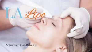 Woman receiving Actinic Keratosis Removal Treatment Ashbourne