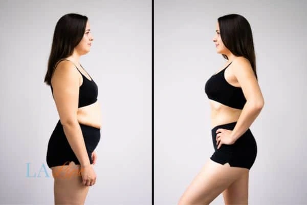 LA-EMS Body Sculpting Ashbourne results before and after of womans results on body toning.