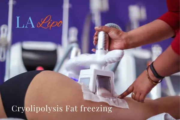 women getting fat freezing Ashbourne
