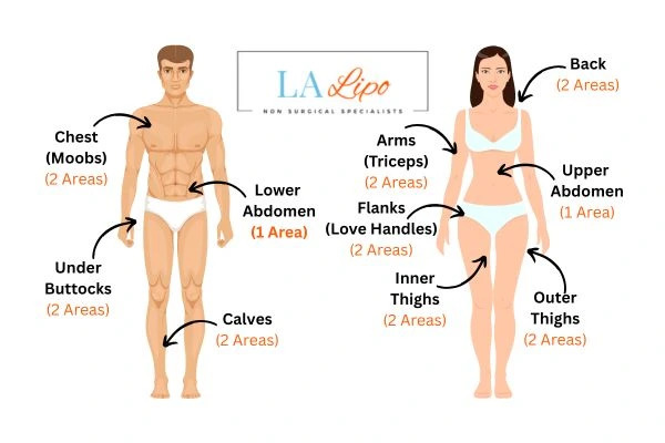 LA LIPO Cryolipolysis Areas Ashbourne