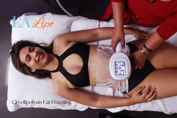 woman getting cryolipolysis Ashbourne